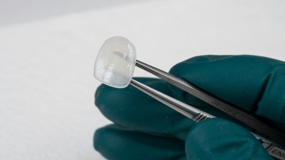 임시 라미네이트